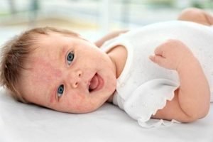 حساسیت کودک به لبنیات گاوی